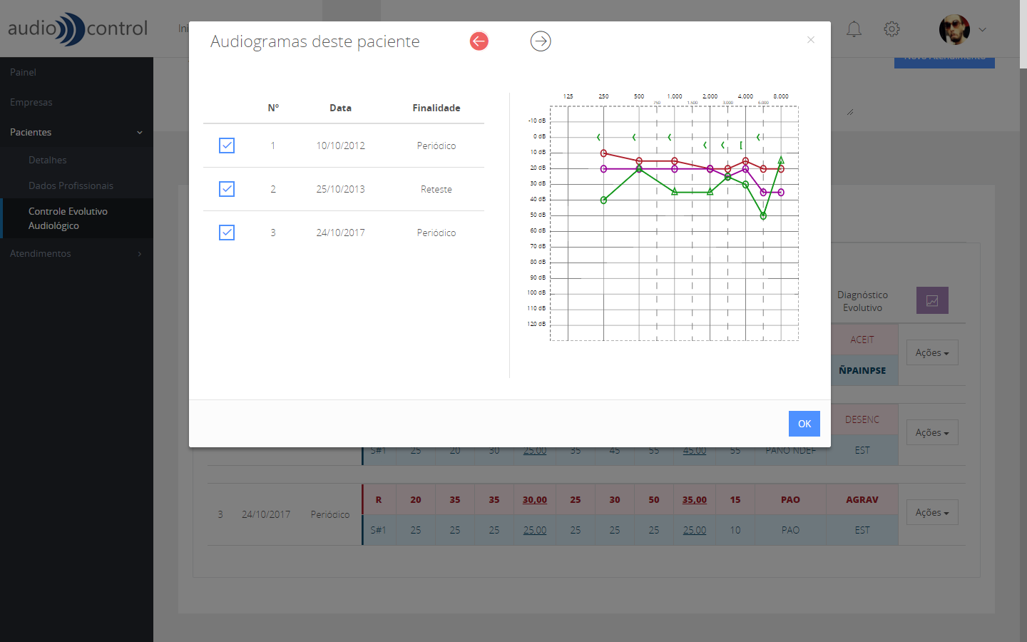 Audiogramas do Paciente